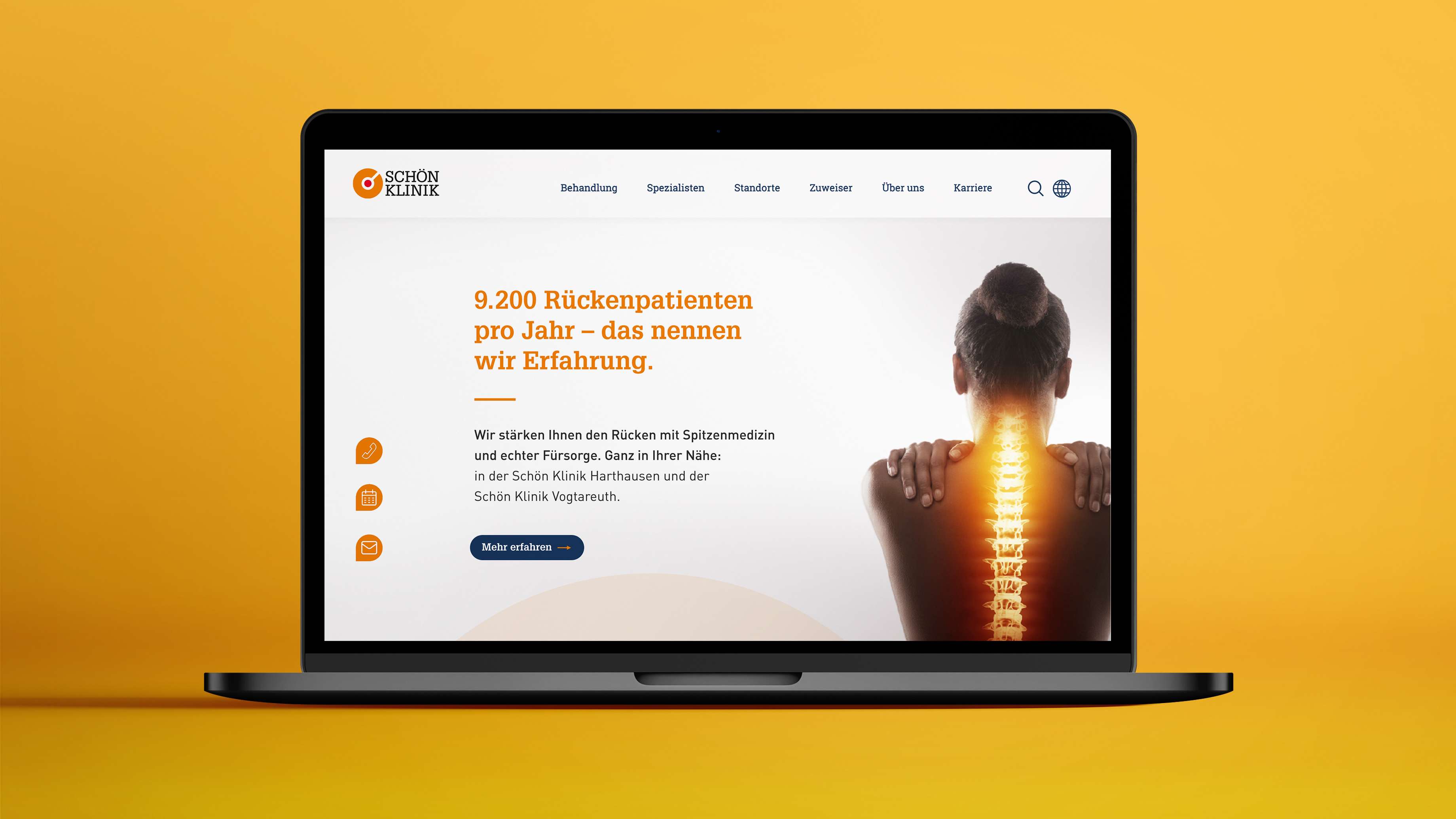 Mockup der Website zur Akquisekampagne der Schön Klinik in einem MacBook inkl. dem Keyvisual (eine Frau in der Rückenansicht, deren Wirbelsäule orange hervorgehoben ist, daneben ein kurzer Text, der beschreibt, dass die Schön Klinik 9.200 Rückenpatienten pro Jahr betreut und dementsprechend viel Erfahrung hat) und der Hauptnavigation
